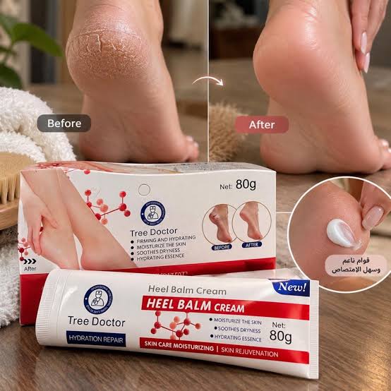 Нанесување на Heel Balm крема на петата